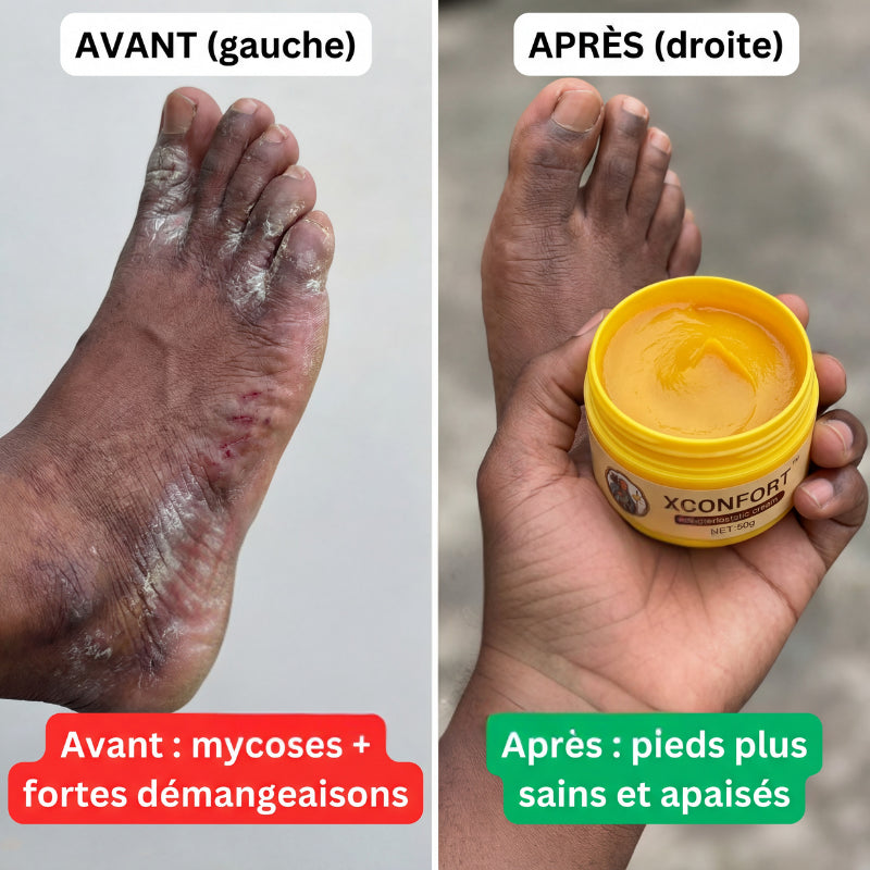 Avant apres 3