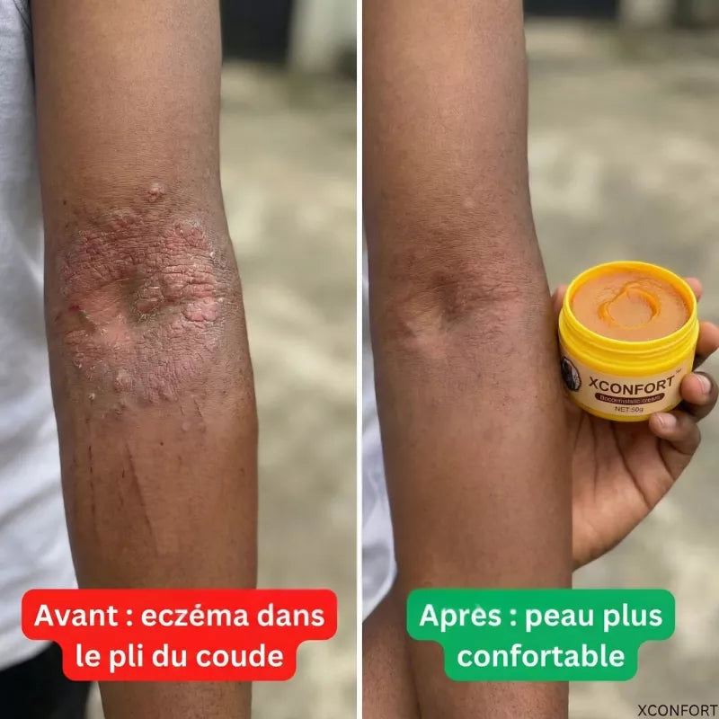 Avant apres 9