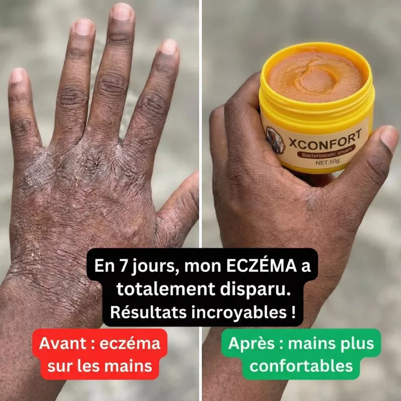 Avant apres 1