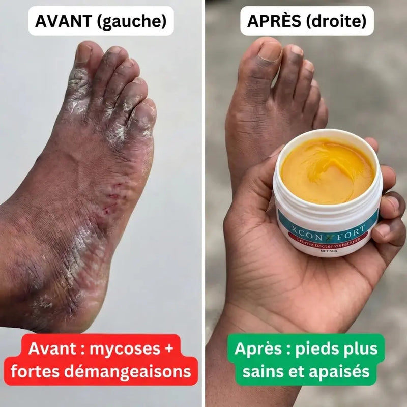 Avant apres 3